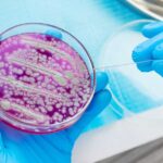 DEADLY Superbug SPREADS — 27 States Hit Scientist using a sterile tool to manipulate bacterial culture in a petri dish