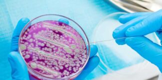 Scientist using a sterile tool to manipulate bacterial culture in a petri dish