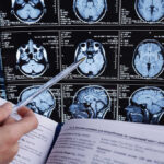Coffee Study Stuns Brain Experts Person analyzing brain MRI images with a pen.