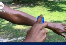 FDA Finally Budges: New Sunscreen Arrives What to know about the FDA's newly approved sunscreen ingredient